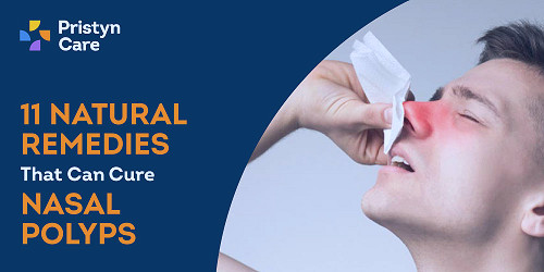 11 Natural Remedies That Can Cure Nasal Polyps - Pristyn Care